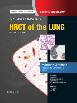 cover image of HRCT of the Lung